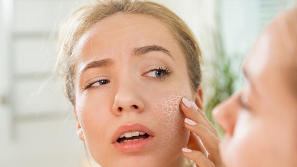 Cara Merawat Kulit Kering Agar Tetap Lembap Seharian