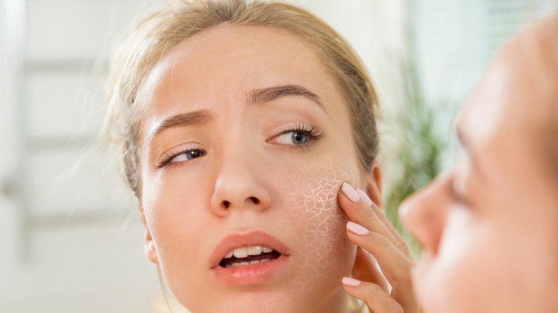 Cara Merawat Kulit Kering Agar Tetap Lembap Seharian