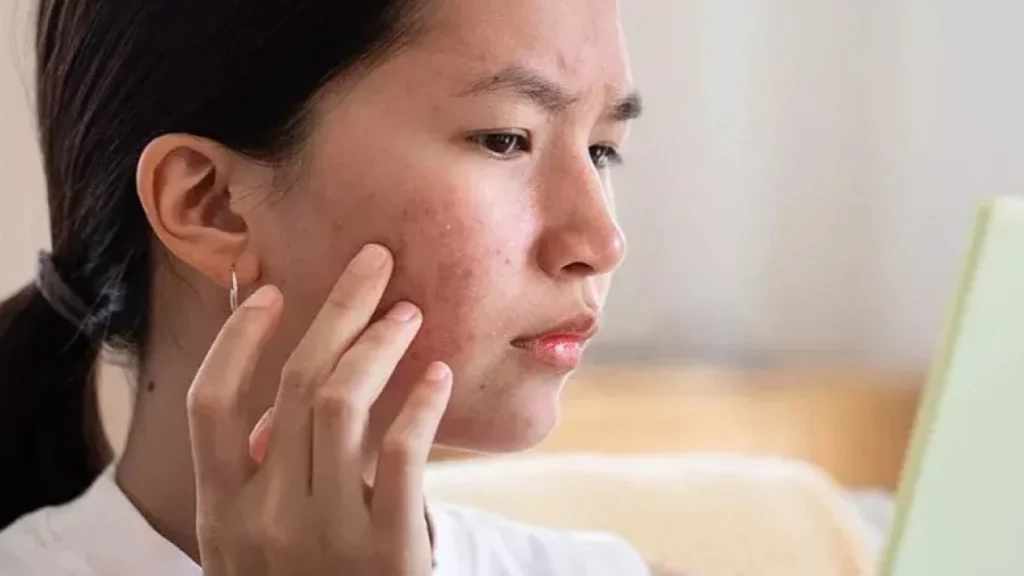 Kesalahan Fatal dalam Perawatan Wajah