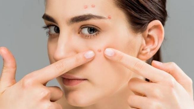 Fatal Perawatan Wajah yang Membuat Jerawat Tak Kunjung Hilang